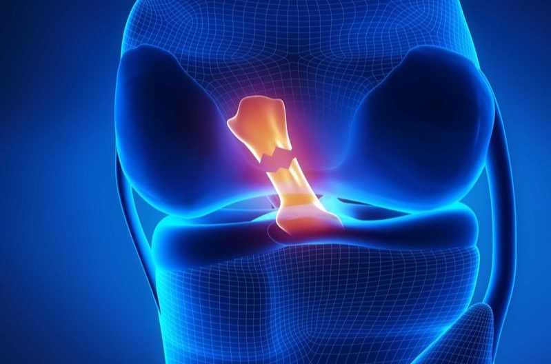 lesioni legamentose